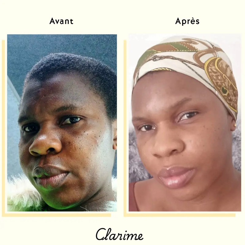 Chidima — before and after