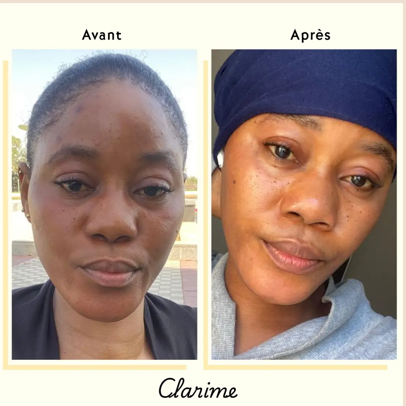 Adjoua — before and after