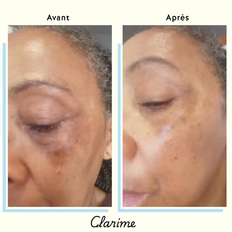 Customer — before and after