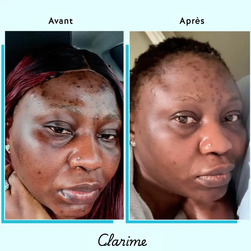 Rokhaya — before and after