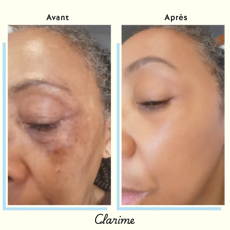 Customer — before and after